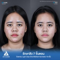 เมนูของร้าน Attitude Clinic  ห้วยขวาง