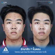 เมนูของร้าน Attitude Clinic  ห้วยขวาง