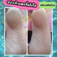 สถาบัน 789 Academy นวดสลายไขมัน