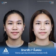 เมนูของร้าน ATTITUDE CLINIC เชียงราย