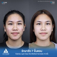 เมนูของร้าน Attitude Clinic  ห้วยขวาง