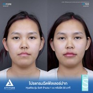 เมนูของร้าน Attitude Clinic  ห้วยขวาง