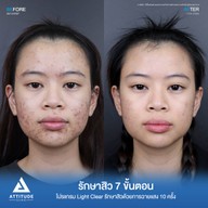 เมนูของร้าน Attitude Clinic  ห้วยขวาง