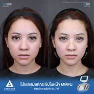 เมนูของร้าน Attitude Clinic  ห้วยขวาง