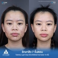 ATTITUDE CLINIC เชียงราย
