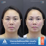 เมนูของร้าน Attitude Clinic  ห้วยขวาง