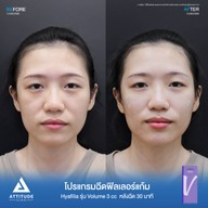 เมนูของร้าน Attitude Clinic  ห้วยขวาง