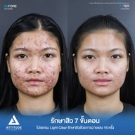 เมนูของร้าน Attitude Clinic  ห้วยขวาง