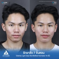 เมนูของร้าน Attitude Clinic  ห้วยขวาง