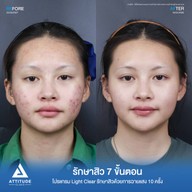 เมนูของร้าน Attitude Clinic  ห้วยขวาง