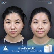 เมนูของร้าน ATTITUDE CLINIC เชียงราย