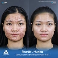 เมนูของร้าน ATTITUDE CLINIC เชียงราย