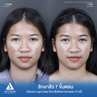 เมนูของร้าน Attitude Clinic  ห้วยขวาง