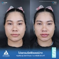 เมนูของร้าน Attitude Clinic  ห้วยขวาง