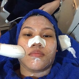 นวดหน้า ด้วยเครื่อง Cryo ผลักตัวยาเข้าผิวอีกครั้ง เพื่อความสดใส เรียบเนียนขึ้น