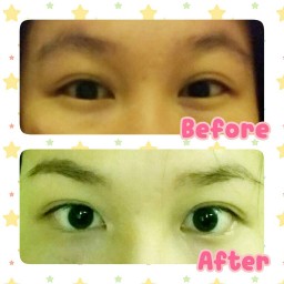 Before-After