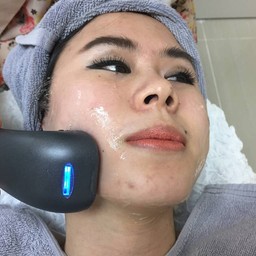 ยกกระชับบริเวณแก้มค่ะ