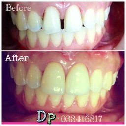 Dental Point Clinic pattaya  คลินิกดัดฟัน ร้านจัดฟัน ทำฟัน พัทยา