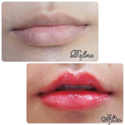 เปลี่ยนปากให้เป็นกระจับด้วยเทคนิคการเพ้นท์ไม่เจ็บไม่ต้องผ่าตัด