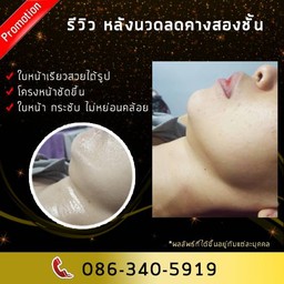 หมดกังวลเรื่อง 'เหนียง' 
 -เห็นผล ใบหน้ากระชับขึ้น
 -ไม่เจ็บ เราไม่ใช่การฉีดหร