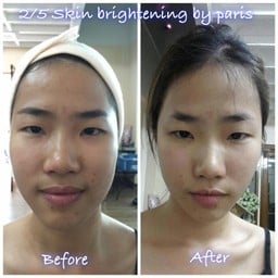 นวดหน้าเรียว V-Shape ปรับโครงหน้าด้วยมือเปล่าปลอดภัย 100% ผิวหน้าขาวกระจ่างใส