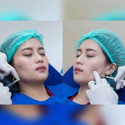 มาร์กยาชาก่อนน๊า ไม่ต้องกลัวเจ็บ