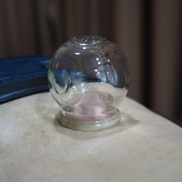 การครอบแก้ว