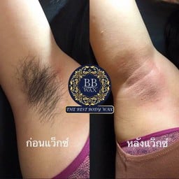 แว็กซ์ขนรักแร้ ลดกลิ่นตัว เสริมความมั่นใจ
