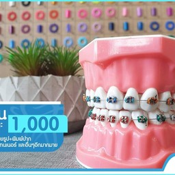 โปรโมชั่นจัดฟัน