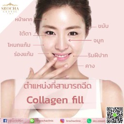 #รูปหน้าสวยได้โดยไม่ต้องผ่าตัด   สำหรับผู้ที่มีปัญหา ต่างๆ สามารถแก้ใข ได้ด้วยกา