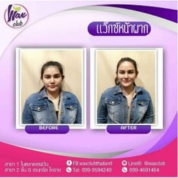 แว็กซ์หน้าผาก
