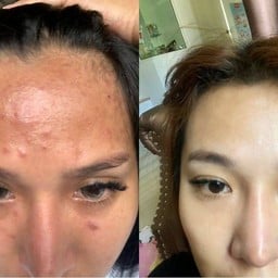 M Vita Clinic - คลินิกรักษาสิว Asoke Montri