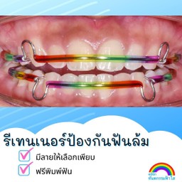 รีเทนเนอร์ สีรุ้ง