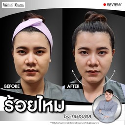 เราทำที่นี่เลย