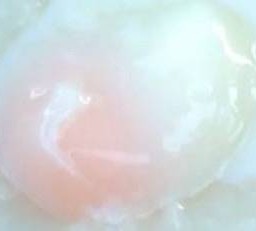 ไข่ลวกเพื่อสุขภาพ