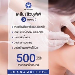 กดสิวทั่วหน้า 500 บาท
แถมมาร์คฟรี 3 ขั้นตอน