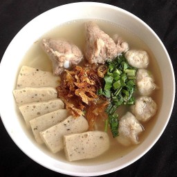 เส้นเล็กซี่โครง