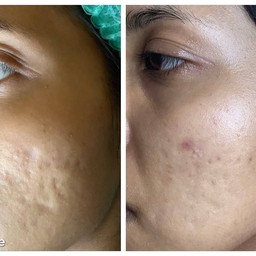 รูปหน้าด้านซ้ายค่ะ