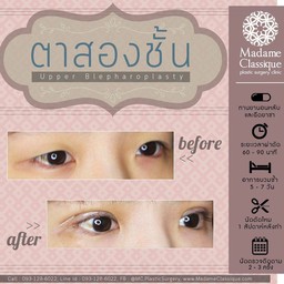 มาดาม คลาสสิก ศัลยกรรมตกแต่ง (Madame Classique) อ่อนนุช 30