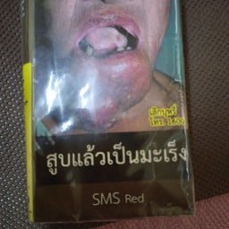 SMS แดง