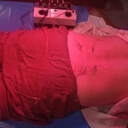 stkสหคลินิก นวดจัดกระดูกฝังเข็ม แผนไทย จีน มี2สาขา หางดงและประตูเชียงใหม่