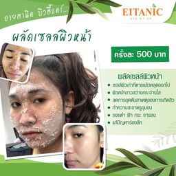 ผลัดเซลล์ผิว ได้ผิวใหม่ ย่นระยะเวลาทาครีมได้ ถือว่าโคตรคุ้ม