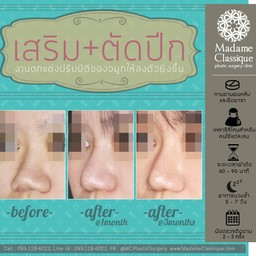 มาดาม คลาสสิก ศัลยกรรมตกแต่ง (Madame Classique) อ่อนนุช 30