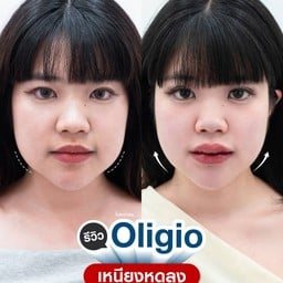 โปรแกรม Oligio 🧏🏻‍♀️