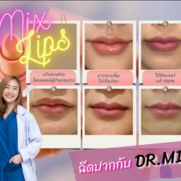 ดูผลงานฟิลเลอร์ปากคุณหมอไว้เยอะ เลยไม่ถูกเลย แชทถามก่อนเข้าแอดก็ให้ข้อมูลดีมาก ม