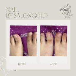 เล็บขบ #ร้านตัดเล็บขบ #ตัดเล็บขบ #ตัดเล็บขบบางนา #ตัดเล็บขบลาซาล #ตัดเล็บขบกรุงเ