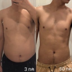 Luxe Bangkok Clinic ศูนย์ความงาม