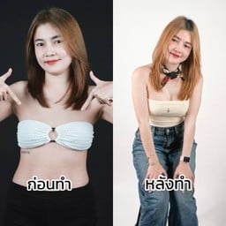 AM international Hospital (AMARA LIPOSUCTION CENTER) รัชโยธิน, ราชพฤกษ์