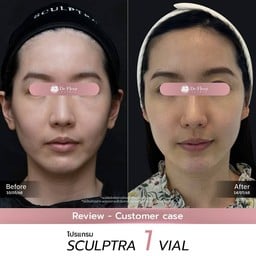 De Fleur Clinic by Dr.Aoey เดอเฟลอร์ คลินิกความงาม สาขาอยุธยา