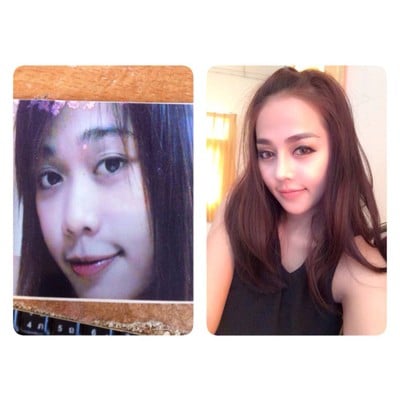 Meko Clinic (เมโกะ คลินิก) เซ็นทรัลเวิลด์ Meko Clinic (เมโกะ คลินิก) เซ็นทรัลเวิลด์